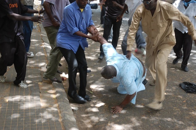 Agression d’Alioune Tine : les photos de l’horreur qui interpellent le procureur.