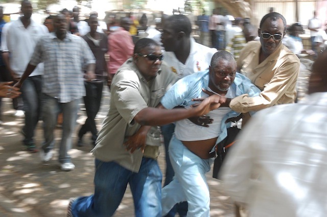 Agression d’Alioune Tine : les photos de l’horreur qui interpellent le procureur.