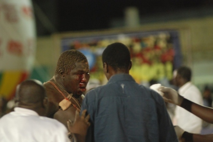 [ PHOTOS ] Elton - Tapha Tine : un exercice répugnant de violence sanglante.