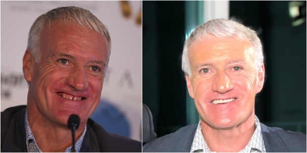 Didier Deschamps s’est fait une nouvelle dentition : Transformation remarquable !