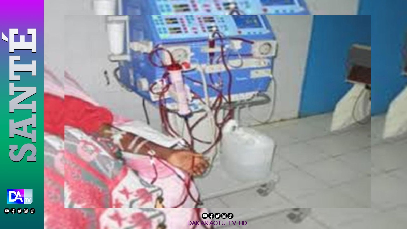 Hôpital Roi Baudouin de Guédiawaye : Les insuffisants rénaux tirent la sonnette d’alarme