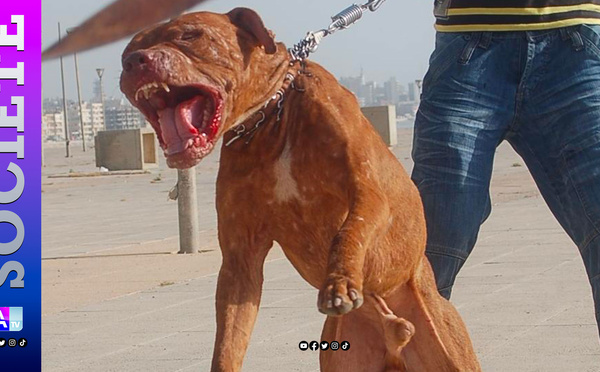 Folie aux Parcelles Assainies : Un maçon lâche son Pitbull sur un élève en pleine fuite !